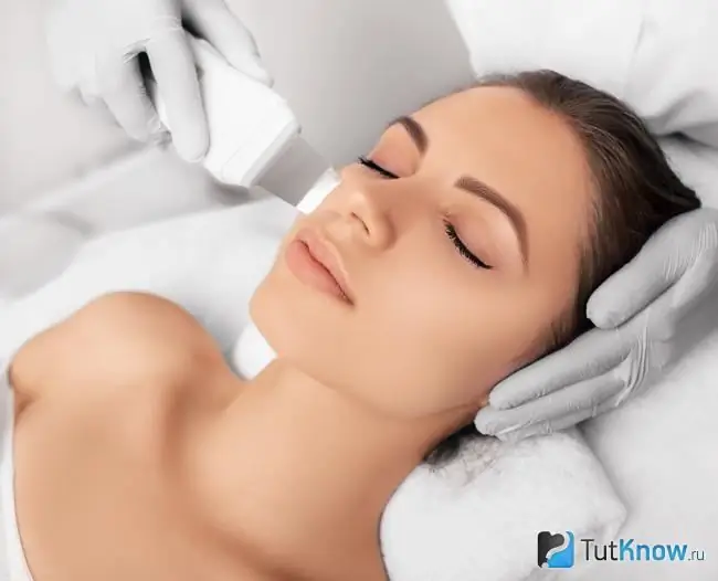 Ultrasonic cleaning of the face from white spots