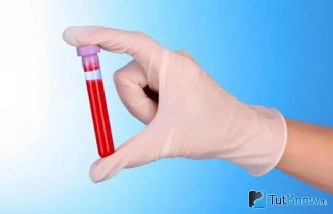 Test tube with blood sample in hand