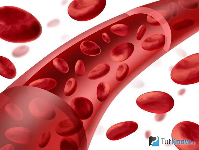 A graphic representation of a blood vessel and red blood cells