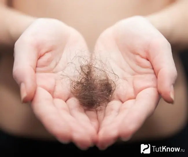 Hair loss